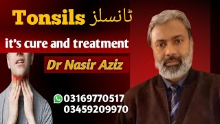 Tonsillitis and its treatment Homeopathic DrNasir Aziz Consult us before operation [upl. by Brook812]