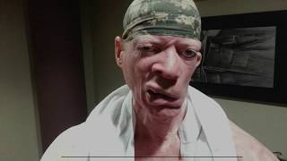 The Story of a dancehall king King Yellowman [upl. by Happy42]