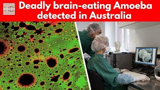 Urgent alert Deadly braineating Amoeba detected in Australia [upl. by Fairbanks]