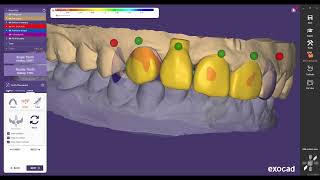 Zircon Coping Design in Exocad [upl. by Faso]