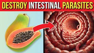 5 Natural Foods To DESTROY Intestinal Parasites [upl. by Anairdna678]