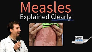 Measles rubeola Explained Clearly by MedCramcom [upl. by Clausen361]