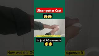 ulnar gutter cast shortsviralvideo viralvideo shortsfeeds [upl. by Fidelas]