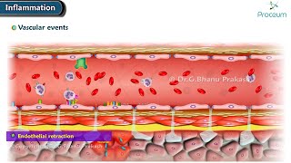 2 Acute Inflammation Vascular Events Animation [upl. by Liagaba]