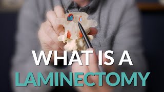 What is a Laminectomy  Spine Surgery Basics [upl. by Saltsman]