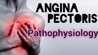 PATHOPHYSIOLOGY OF ANGINA PECTORIS [upl. by Aneerahs]