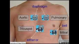 AUSCULTATION OF HEART SOUNDS [upl. by Kahaleel]