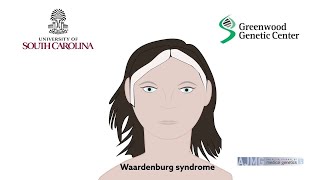 Biallelic deletions of the Waardenburg II syndrome gene SOX10 cause a recognizable arthrogryposis [upl. by Grossman]