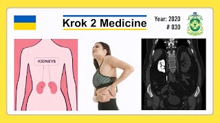 Krok 2 Medicine  Year 2020  030 Ministry of Public Health of Ukraine [upl. by Polky322]