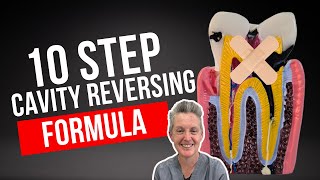 The 10Step Dental Cavity Reversing Formula Holistic Dentist Brisbane [upl. by Tat]