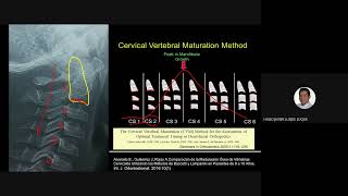12 ANÁLISIS DE VÉRTEBRAS CERVICALES [upl. by Anirroc]