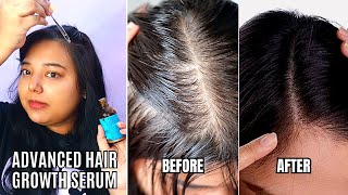 How To Apply Pilgrim Hair Growth Serum For Hair Regrowth Pilgrim Redensyl Anagain Hair Growth Serum [upl. by Asseniv]