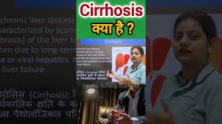 Cirrhosis क्या है cirrhosis cirrosis livercirrhosis hepatitis alcoholic trending nursing [upl. by Ymereg]