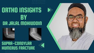 Dr Jalal Orthopedics made easySUPRACONDYLAR HUMERUS FRACTURE [upl. by Noellyn507]