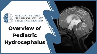 Overview of Pediatric Hydrocephalus [upl. by Rolf]