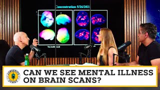 Can we see mental illness on brain scans [upl. by Leile]