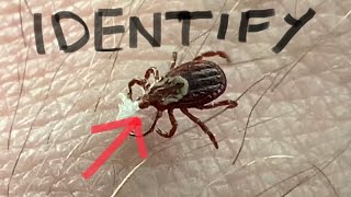 TRICKS for TICKS Photo Identification  PICTURES [upl. by Akino]