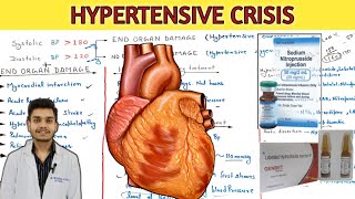 Hypertensive crisis hypertensive urgency and hypertensive emergency treatment in hindi [upl. by Hoon]