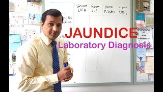 Jaundice  Laboratory Diagnosis [upl. by Tomaso829]