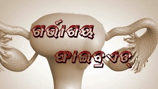 Uterine Fibroid Symptoms amp Treatment ଗର୍ଭାଶୟ ଫାଇବ୍ରଏଡର ଲକ୍ଷଣ ଓ ଚିକିତ୍ସା [upl. by Schwejda]