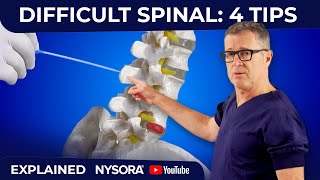 What to do when the needle encounters the bone during spinal or lumbar puncture [upl. by Waine372]