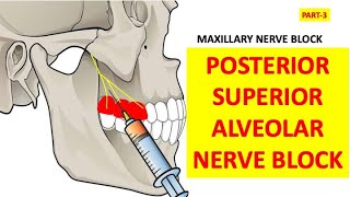 PSA POSTERIOR SUPERIOR ALVEOLAR NERVE BLOCK Oral surgery Nerve blocks Maxillary blockdental [upl. by Carce722]