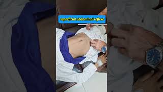 Superficial abdominal reflex eliciting method neurology pediatrics clinicalexamination [upl. by Barboza569]