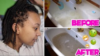 ACV Rinse on Locs  GROSS RESULTS 🤢😷Remove buildup with Apple Cider Vinegar [upl. by Arramat]