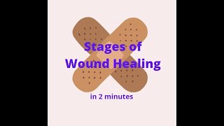 Stages of Wound Healing in 2 mins [upl. by Casie]