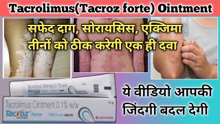 tacrolimus ointment 01 ww review  tacrolimus ointment  tacroz forte 01 ointment  tacroz forte [upl. by Seto]