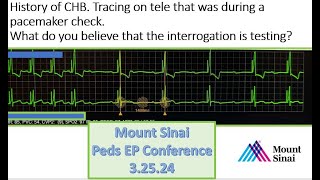 Mount Sinai Pediatric EP Conference 32524 [upl. by Nere]