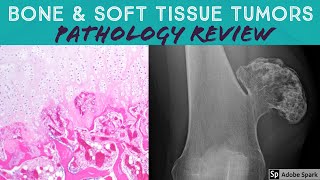 Bone amp Soft Tissue Pathology Board Review 21 Classic Cases [upl. by Matias]