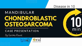 Chondroblastic osteosarcoma of the mandibleOralpathology 360 [upl. by Skillern]