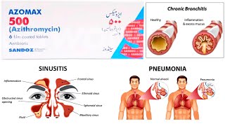 Azomax 500mg Azithromycin tablet uses in Urdu Hindi [upl. by Eecyac]