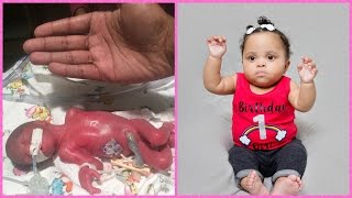 Diors Journey  Preemie Born at 23 Weeks [upl. by Aneema]