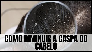 Como diminuir a caspa do cabelo [upl. by Joby]