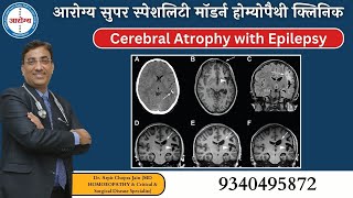 Cerebral Atrophy with Epilepsy Since childhood Treatment Cured by Dr Arpit Chopra Jain [upl. by Seys]