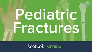 TYPES OF FRACTURES AND COMMON SITE OF FRACTURES IN KIDS [upl. by Ahtamas]