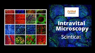 IVIM Microscopy [upl. by Mchail669]