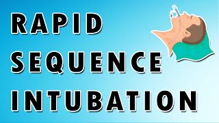 Rapid sequence intubation  Mnemonics [upl. by Roid283]