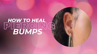 How To Heal Ear Piercing Bump [upl. by Heron]