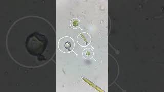 Microorganisms Under Microscope Part 1  Learn Practically euglena paramecium science [upl. by Yasui60]