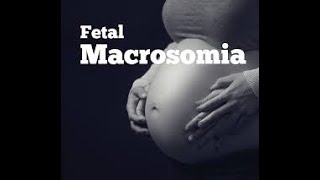 Fetal Macrosomia [upl. by Mossolb45]