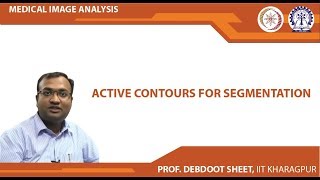 Active Contours for Segmentation [upl. by Joacimah107]