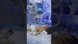 New born baby admission in NICU 😭😭  newbornbaby nicu nicubaby babycare feedshorts neonatal [upl. by Carlen]