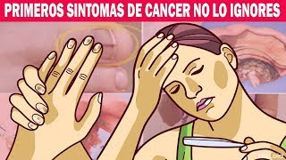 Primeros Síntomas y Signos de Cáncer que no debemos ignorar ¡Mucho Cuidado [upl. by Senoj124]