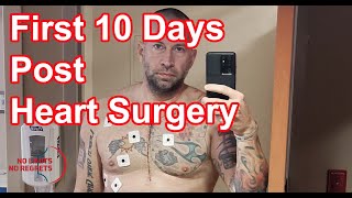 First 10 Days of OPEN HEART Surgery RECOVERY vs Original MITRAL VALVE Replacement Recovery Time [upl. by Dnaletak]