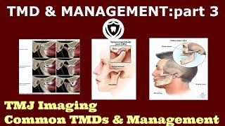 Temperomandibular Disorders amp ManagementPart 3 [upl. by Olihs]