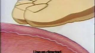 1991 Dermarest Itch Cream Commercial [upl. by Laon]