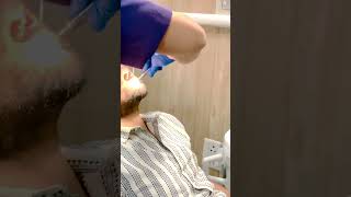 3 molar extraction [upl. by Lexy]